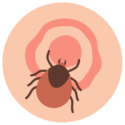 Bulls eye rash from a tick bite