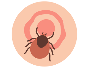 Bulls eye rash tick